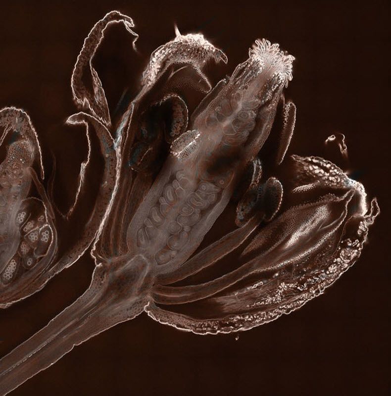 Ранняя стадия развития семязачатка сорняка Arabidopsis thaliana (увеличение х20). Фото сделано в школе биологических наук Оксфордского университета. (DR. JOHN RUNIONS / BARCROFT MEDIA)